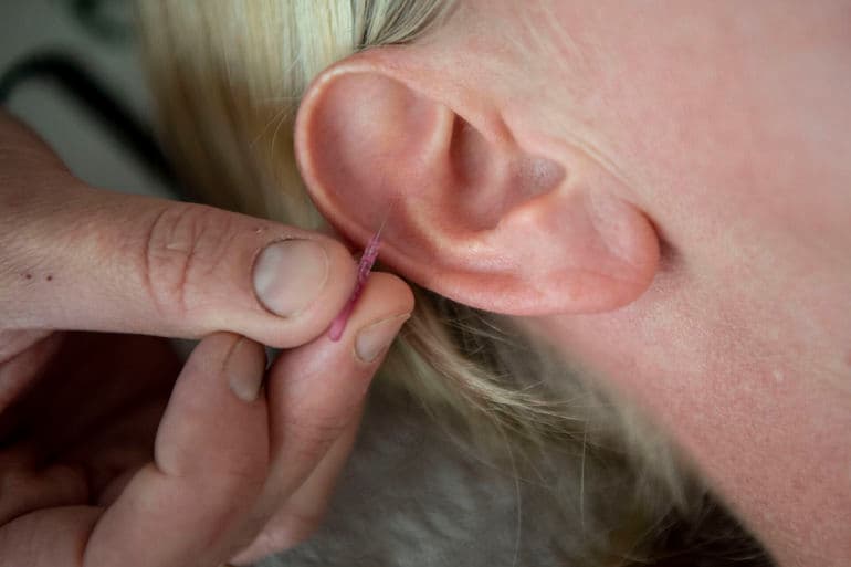 Morten Stricker/Jyskfynskemedier/Ritzau Scanpix