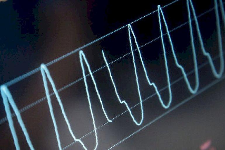 Hjertepatienter venter kortere tid på operationer