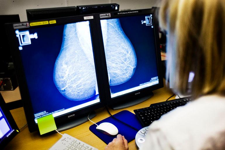 Kunstig intelligens skal opspore brystkræft i Region Syddanmark