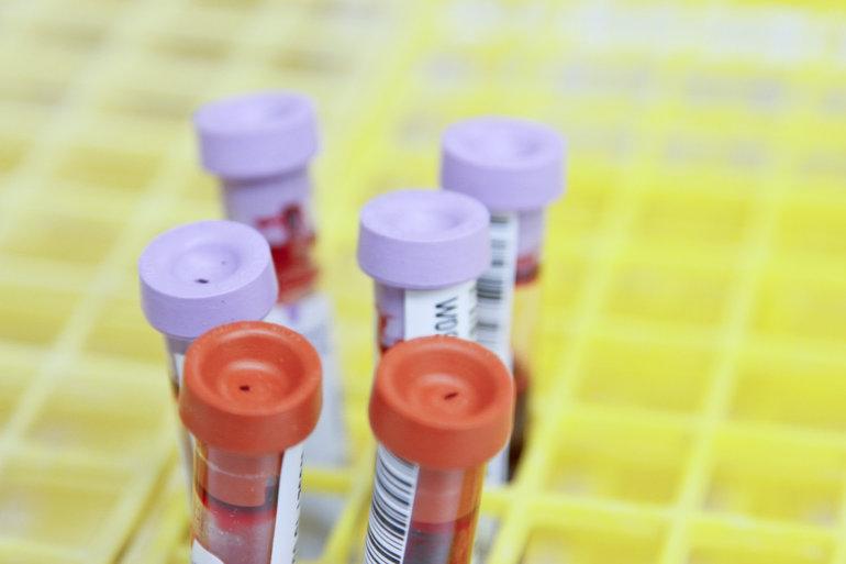 Lovgivning spænder ben: Kalundborg må droppe aftale om blodprøver